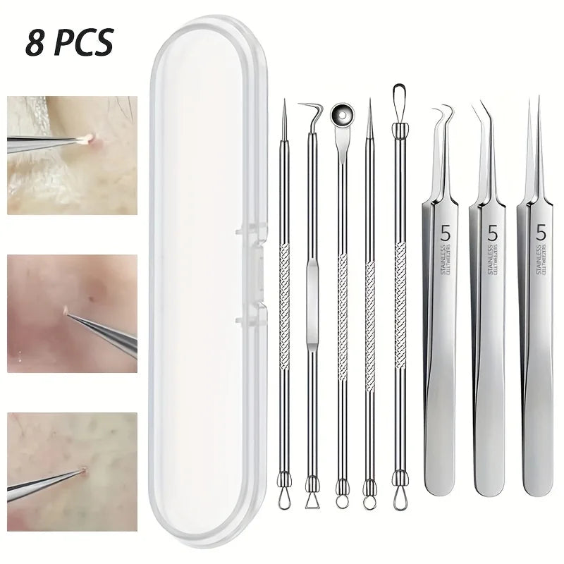 Blemish Extraction Kit